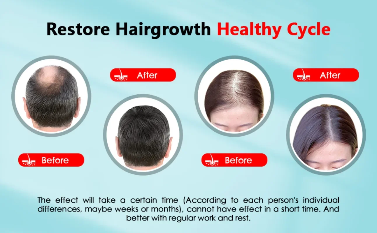 Saç Büyüme Kap Şarj Edilebilir - Hair Care Nutrition incelemesi ve fiyatı