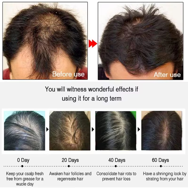 Hızlı Zencefilli Saç Uzatma Sp - Hair Care Nutrition incelemesi ve fiyatı